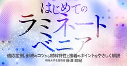 はじめての「ラミネートベニア」