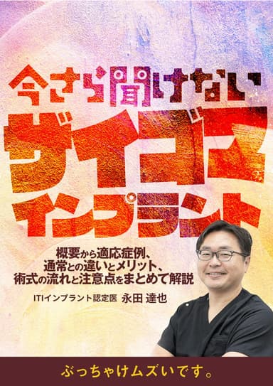 ランキング9位の今さら聞けない「ザイゴマインプラント」