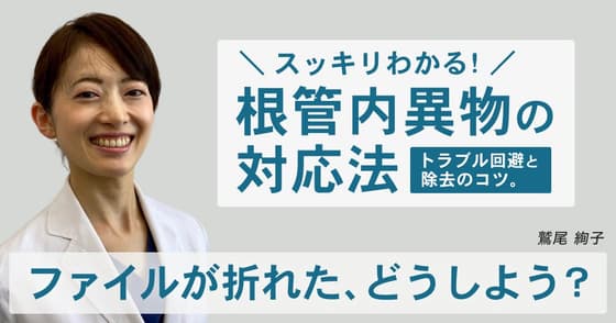 スッキリわかる、根管内異物の対応法