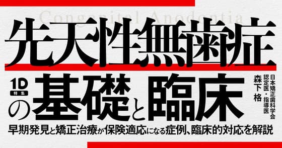 先天性無歯症の基礎と臨床