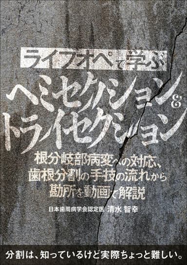 ランキング3位のライブオペで学ぶ「ヘミセクション&トライセクション」