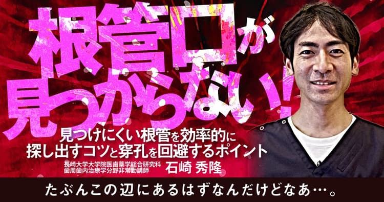 根管口が見つからない！