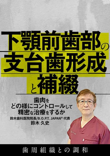 ランキング11位の下顎前歯部の支台歯形成と補綴