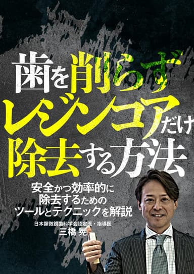 ランキング11位の歯を削らずレジンコアだけ除去する方法