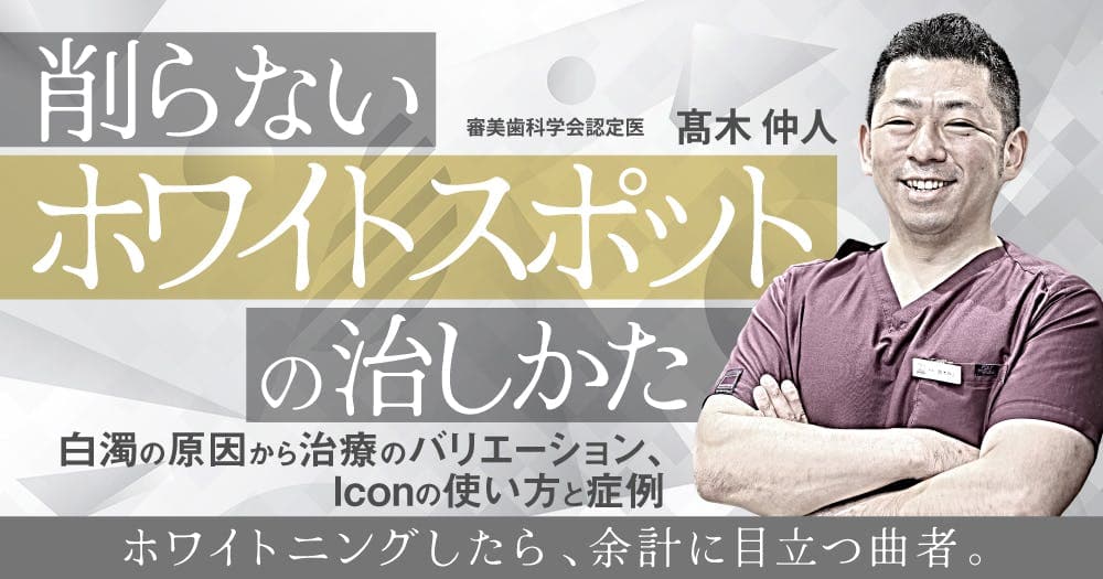 削らない「ホワイトスポット」の治しかた。フッ素塗布以外の方法は？