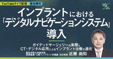 インプラントにおける「デジタルナビゲーションシステム」導入