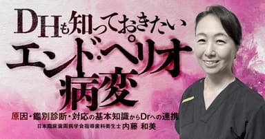DHも知っておきたいエンド・ペリオ病変