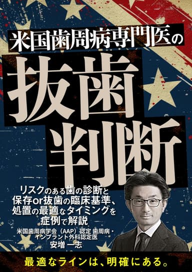 ランキング19位の”米国歯周病専門医”の抜歯判断