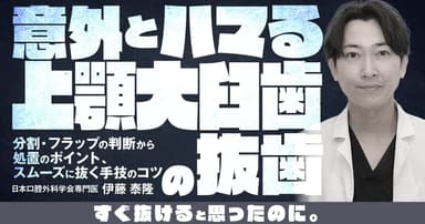意外とハマる上顎大臼歯の抜歯
