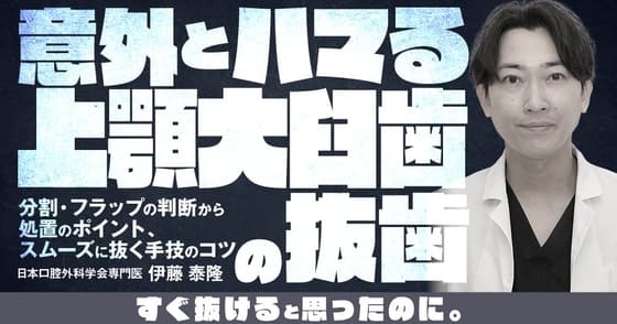 意外とハマる上顎大臼歯の抜歯