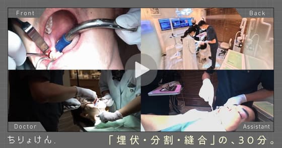 【治療見学】埋伏智歯抜歯（下顎右側第三大臼歯）