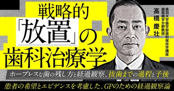 戦略的「放置」の歯科治療学