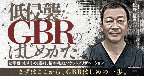 低侵襲なGBRのはじめかた