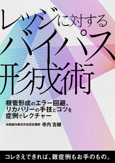 ランキング10位のレッジに対するバイパス形成術