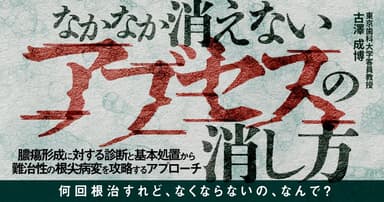 なかなか消えないアブセスの消し方