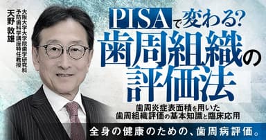「PISA」で変わる？歯周組織の評価法