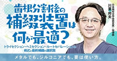 歯根分割後の補綴装置は何が最適？