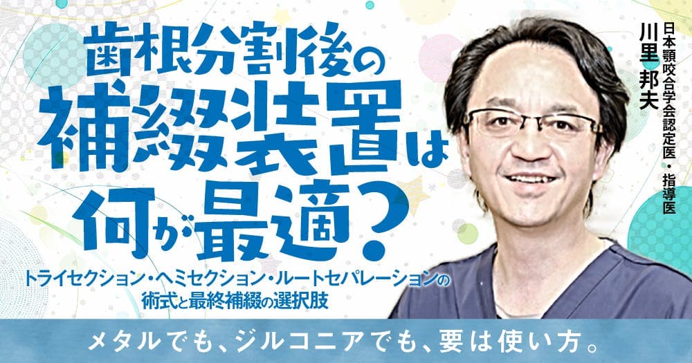 歯根分割後の補綴装置は何が最適？ - トライセクション・ヘミセクション・ルートセパレーションの術式と最終補綴の選択肢