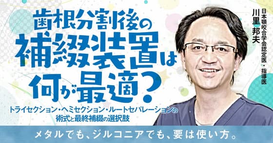 歯根分割後の補綴装置は何が最適？