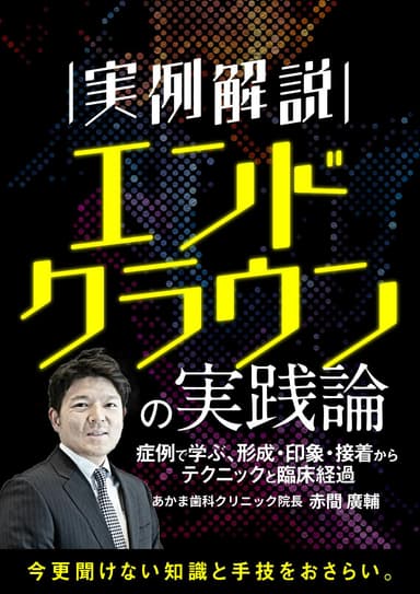 ランキング9位の【実例解説】エンドクラウンの実践論