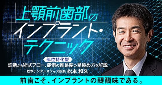 上顎前歯部のインプラント・テクニック