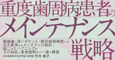 重度歯周病患者のメインテナンス戦略