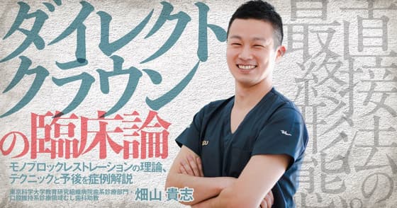ダイレクトクラウンの臨床論