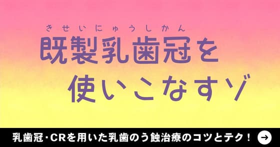 既製乳歯冠を使いこなすゾ！最適な歯冠修復方法は？