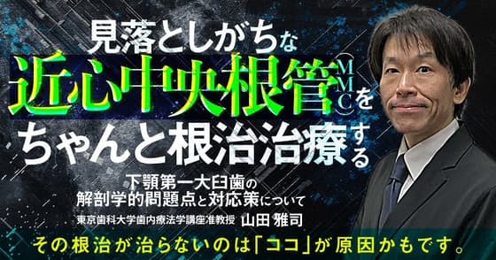 見落としがちな「近心中央根管（MMC）」をちゃんと根管治療する