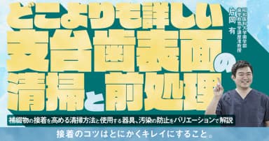 どこよりも詳しい「支台歯表面」の清掃と前処理