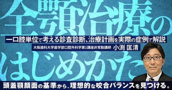 全顎治療のはじめかた