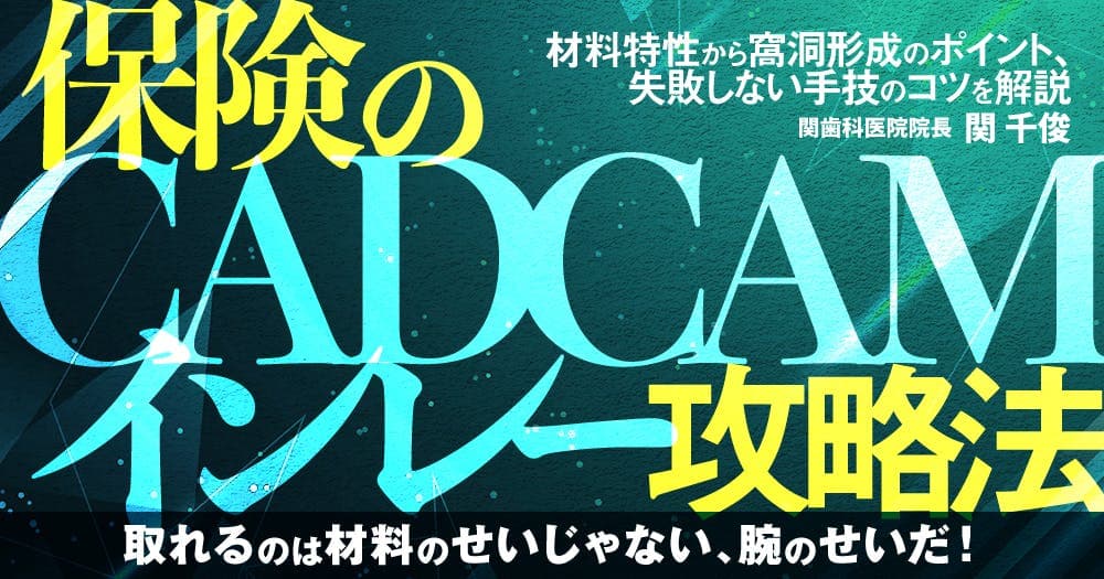 保険の「CADCAMインレー」攻略法 - 材料特性から窩洞形成のポイント、失敗しない手技のコツを解説