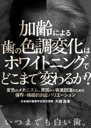 ランキング15位の加齢による歯の色調変化はホワイトニングでどこまで変わるか？