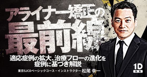 アライナー矯正の最前線