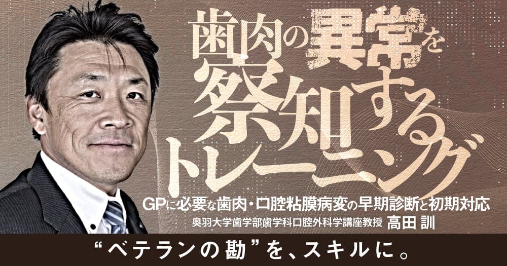 歯肉の異常を察知するトレーニング - GPに必要な歯肉・口腔粘膜病変の早期診断と初期対応