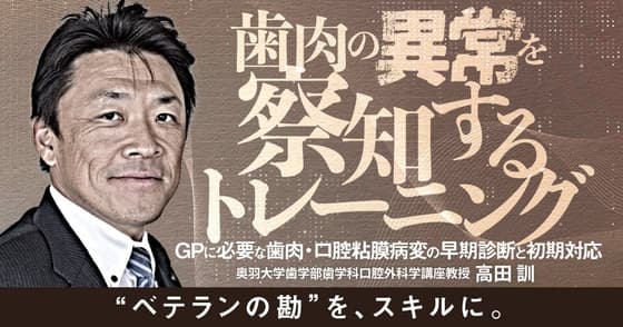 歯肉の異常を察知するトレーニング