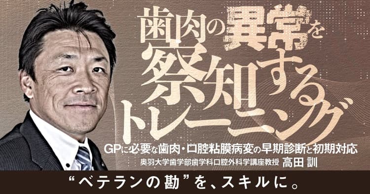 歯肉の異常を察知するトレーニング