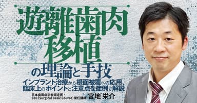 遊離歯肉移植の理論と手技