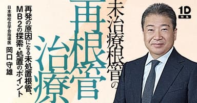 未治療根管の再根管治療