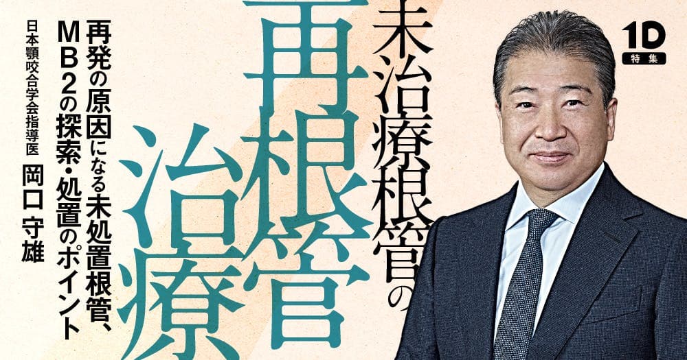 未治療根管の再根管治療