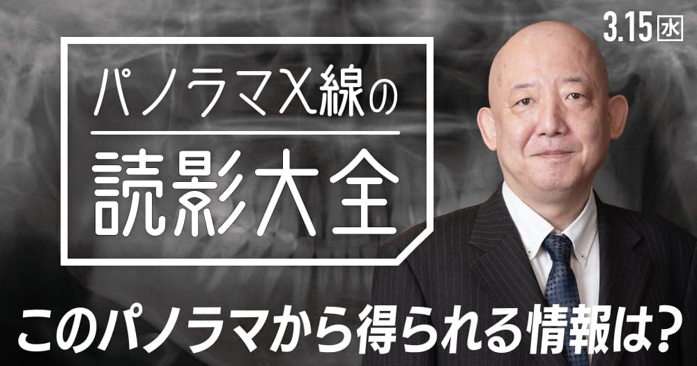 【再放送】 パノラマX線「読影」大全 - 1枚の画像から読み取れるものは？
