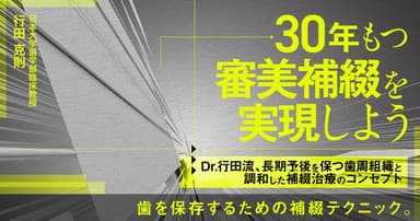 30年もつ審美補綴を実現しよう