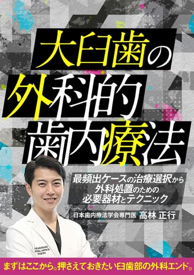 ランキング8位の大臼歯の外科的歯内療法