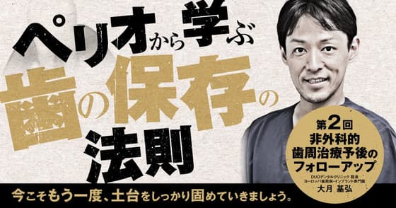 ペリオから学ぶ歯の保存の法則【第二回】