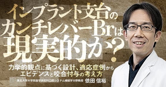 インプラント支台のカンチレバーBrは現実的か？