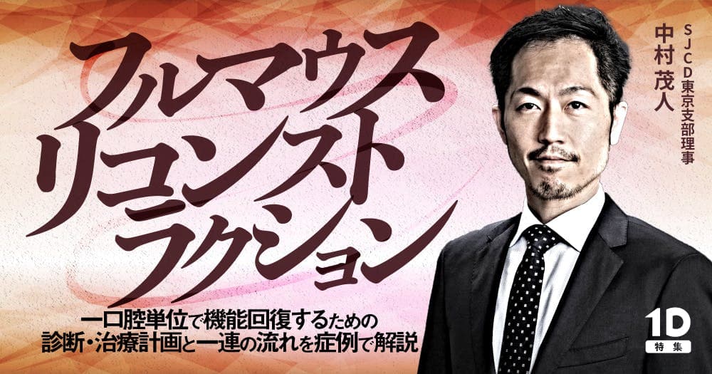 フルマウスリコンストラクション