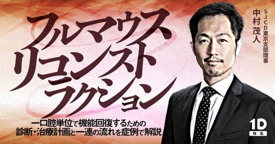 フルマウスリコンストラクション