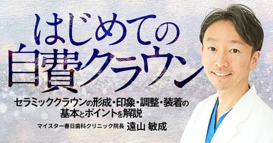 はじめての「自費クラウン」