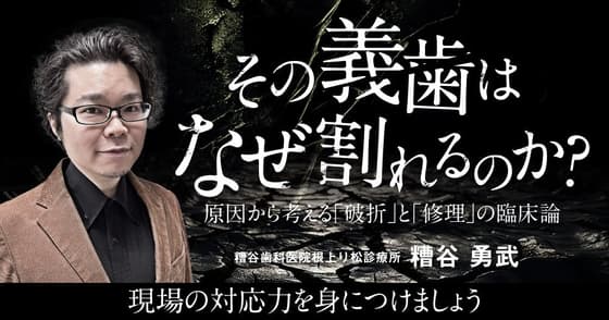 その義歯はなぜ割れるのか？