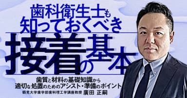 歯科衛生士も知っておくべき「接着」の基本